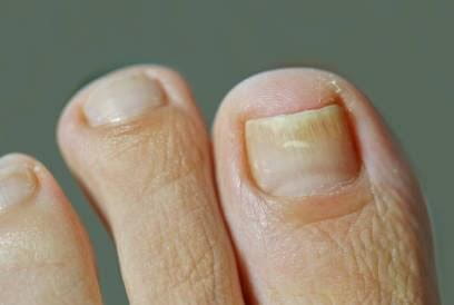 Yellow-Nails-001v2