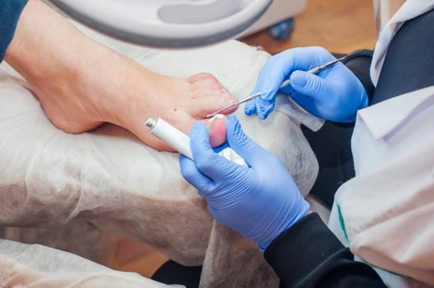 treatment-for-toenails-001